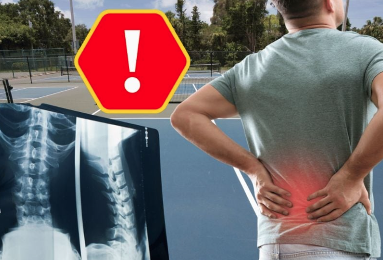 Đau lưng sau khi chơi Pickleball. Lỗi kỹ thuật và giải pháp cho bạn